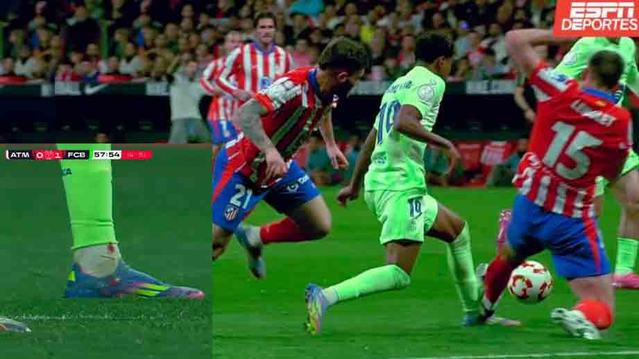 Lolos Final Copa del Rey, Kaki Yamal Kembali Berdarah!