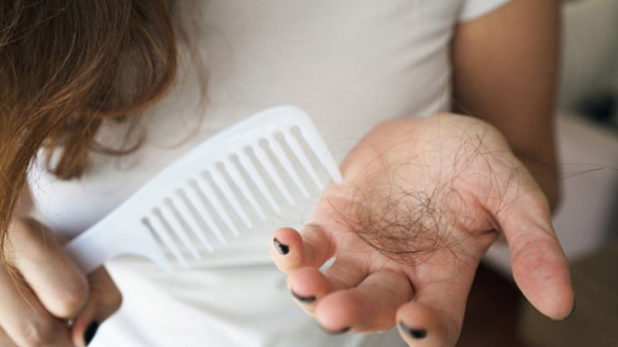 tak-cuma-rambut-rontok-ini-gejala-awal-lupus-yang-wajib-kamu-tahu